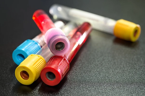 Image for article titled Infected Blood Inquiry – Hepatitis C testing